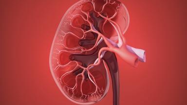 Трансплантация почки